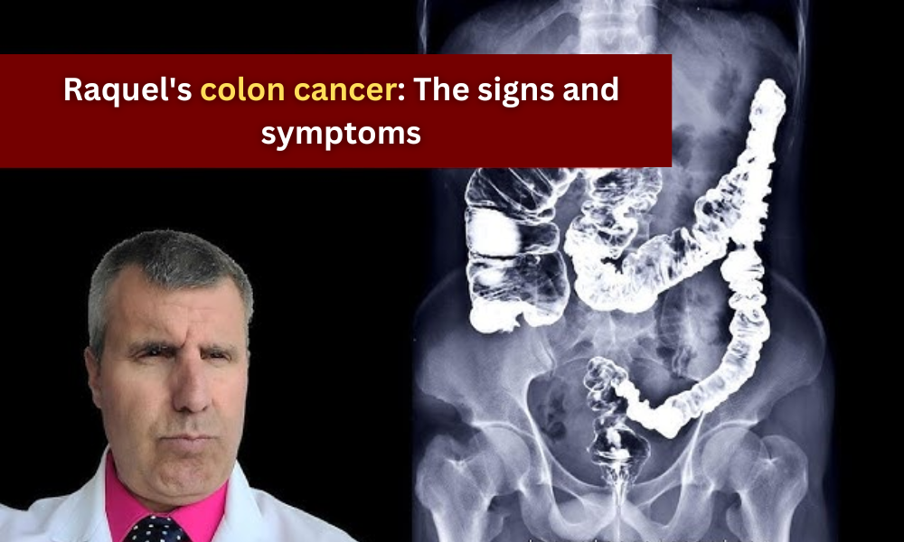 Raquel's colon cancer The signs and symptoms