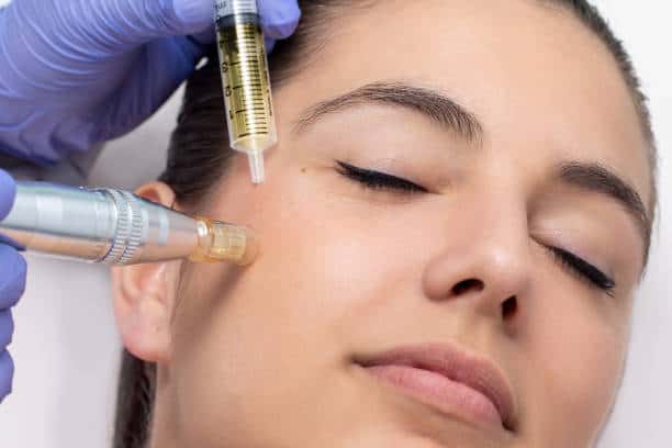 Revitalize Your Skin with PRP Facial Treatments in London: A Natural Approach to Anti-Aging