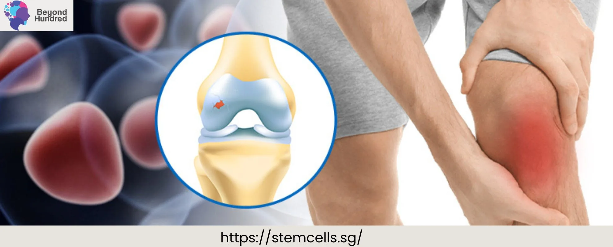 Stem Cell Therapy Singapore