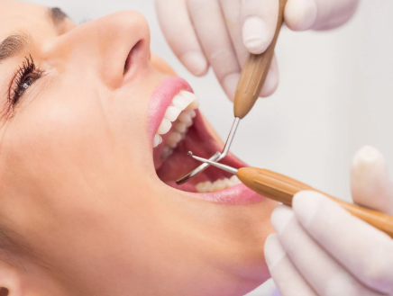 Best dental implants clinics