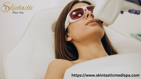 Laser Hair Removal in Riverside