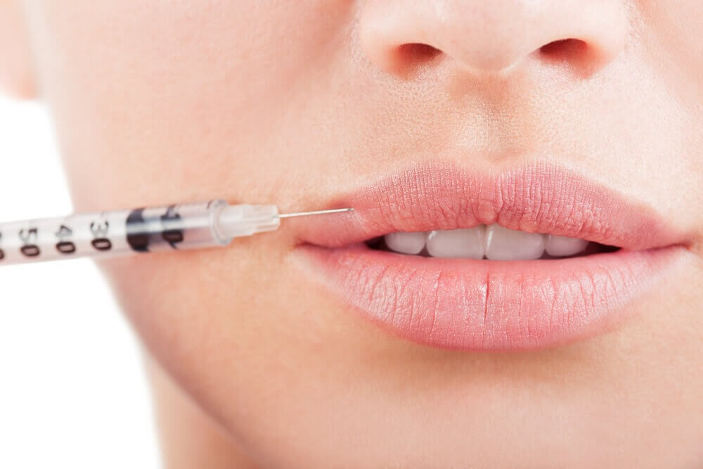 Best Lip Fillers Injections in Dubai