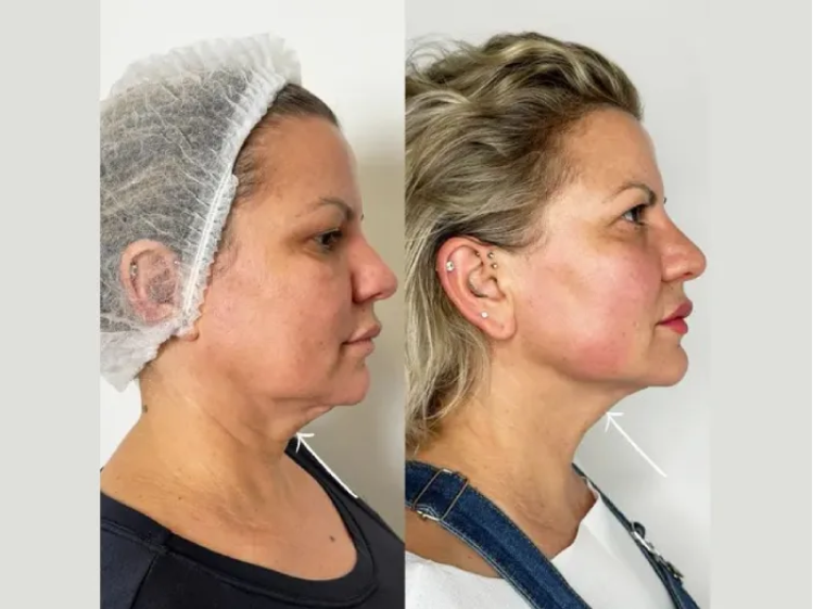 Best Aesthetic Clinic in Dubai: Setting the Standard in Beauty