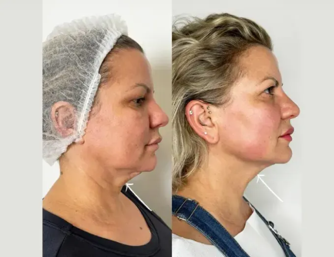 Best Plastic Surgeons in Dubai for Natural-Looking Results