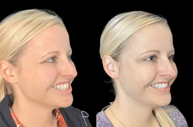 Best Doctors in Dubai for Botox and Cosmetic Enhancements
