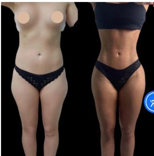 Best Plastic Surgeon in Dubai for Gender-Specific Procedures