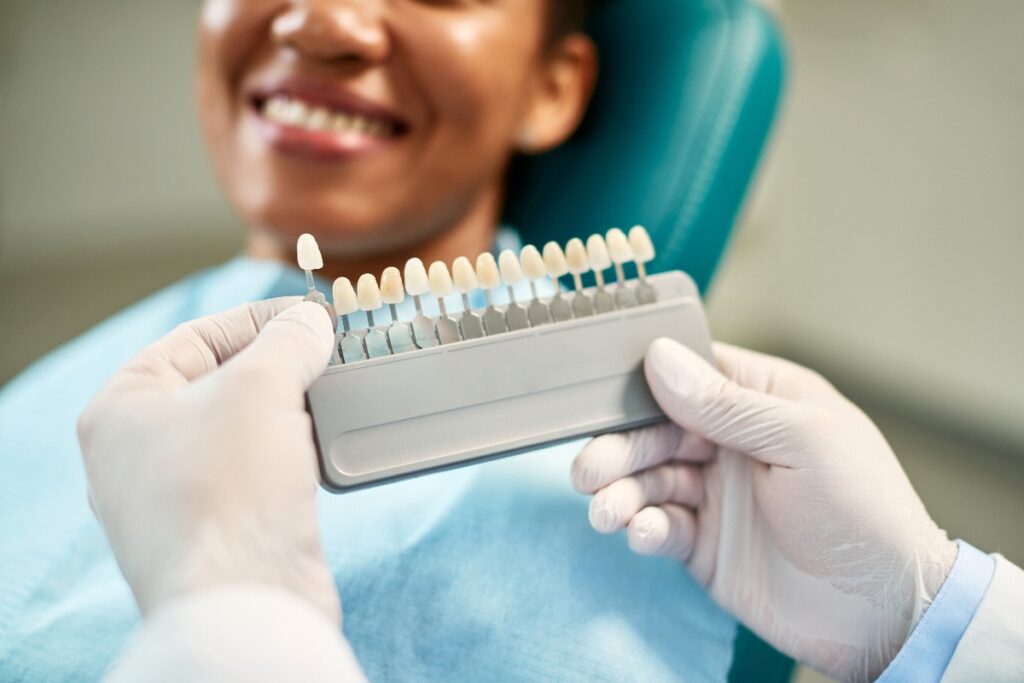 veneer dentistry cost