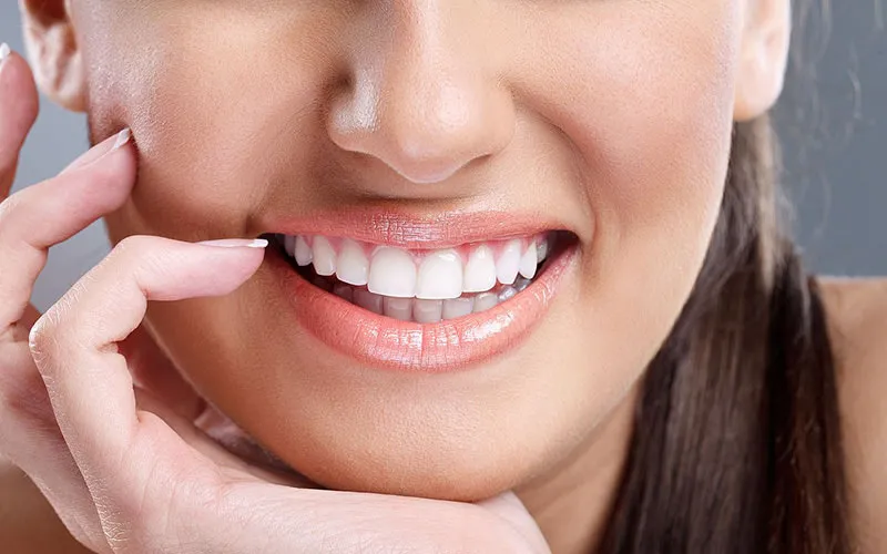 Veneers Dubai