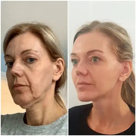 Best Plastic Surgeon in dubai