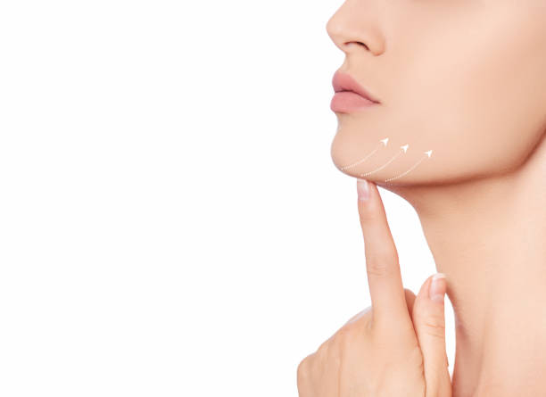 Neck Lift in Jeddah: The Secret to a Sculpted and Elegant Neckline