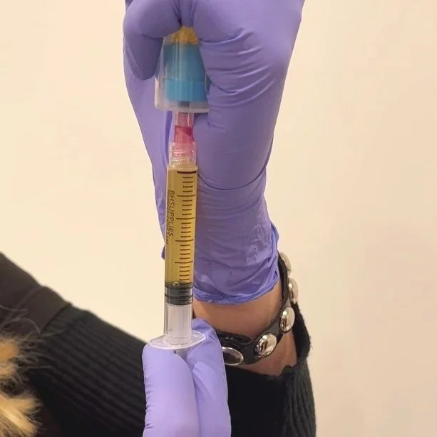 Best treatments for your skin Chicago