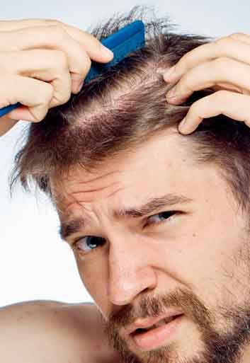 Hair Transplant in Riyadh