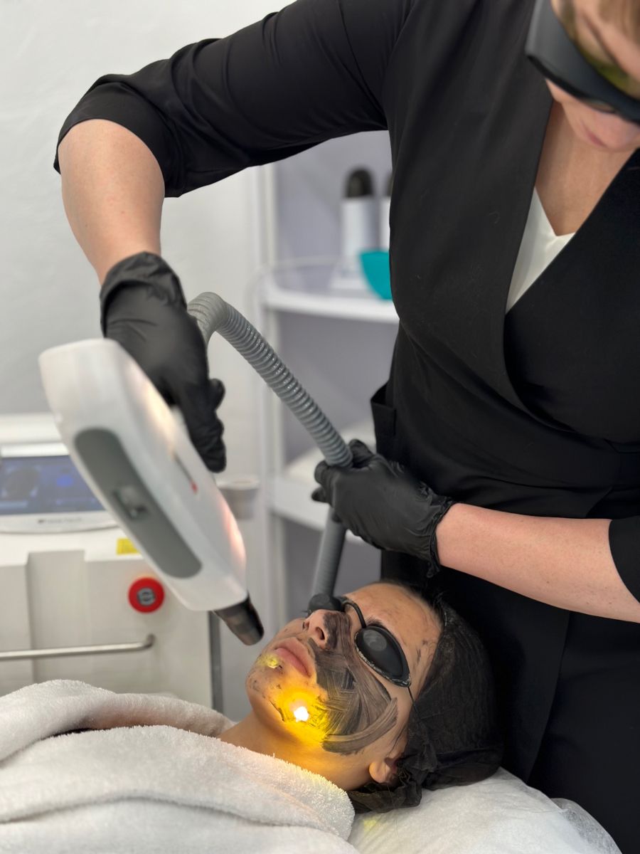 Laser Carbon Peel in Riyadh
