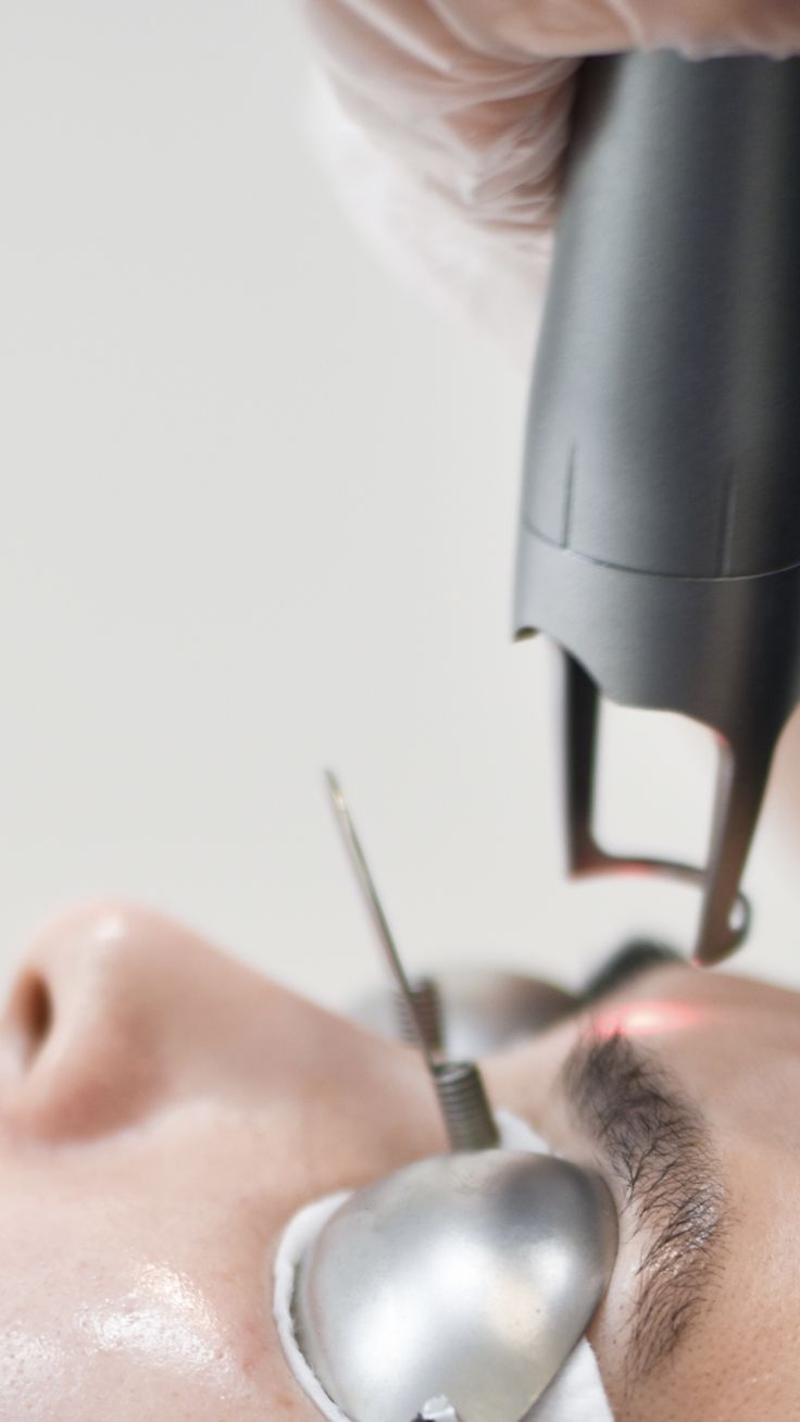 Q-Swithched Laser Treatment in Riyadh