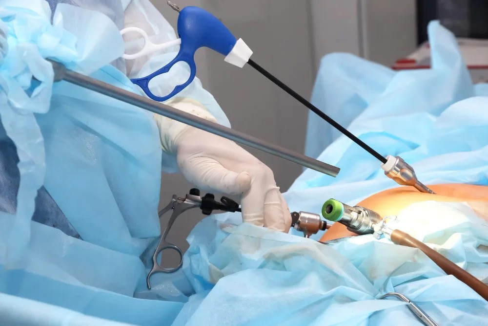 laproscopic surgery in islamabad