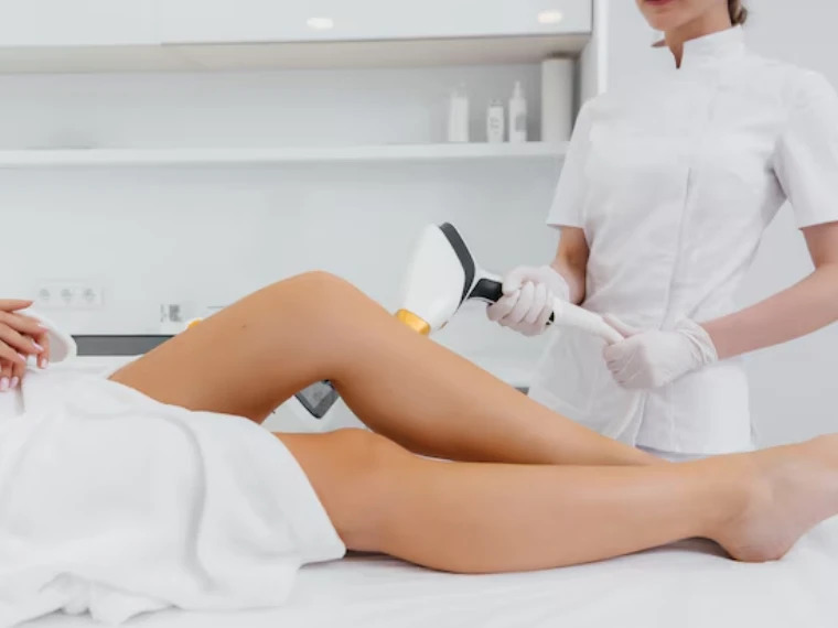 laser hair removal
