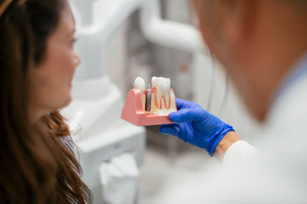 local dental implants