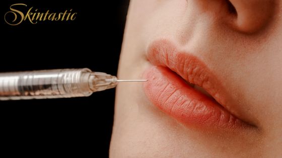 Lip Fillers Riverside