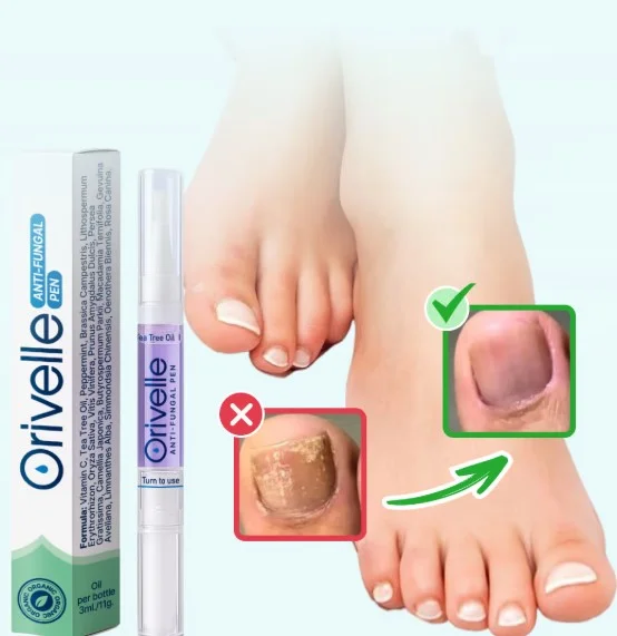 Orville for Toenail Fungus